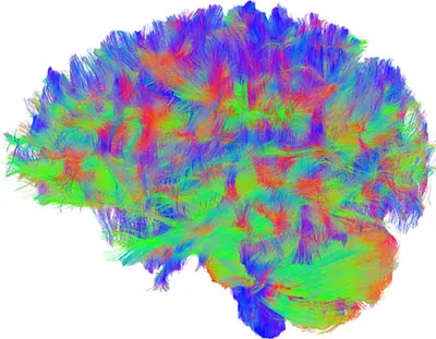 A diffusion MRI reconstruction of white matter tracts, with streamlines coloured by their orientation through the brain.